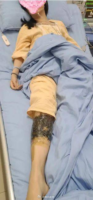 皇冠信用網会员开户
_女子在云南被银环蛇咬伤打了十多支血清皇冠信用網会员开户
，自称2年后仍有后遗症：头晕脸麻，没想到恢复得这么慢