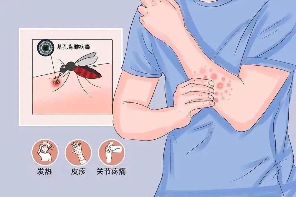 皇冠信用网登2代理
_风险增大皇冠信用网登2代理
！深圳疾控：去这247处要小心！张文宏首次发声